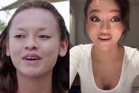 Hết người đẹp tới Á hậu xuất hiện tại địa chỉ thẩm mỹ nổi tiếng